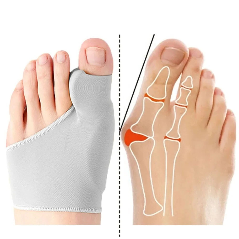1/2Pair Toe Separator Hallux V - Ankle Brace Sock recensie en prijs