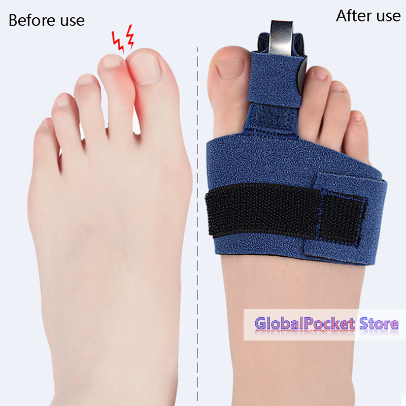 1Pcs Toe Corrector Toe Fractur - Ankle Brace Sock recensie en prijs